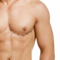 Erkekte Meme Büyümesi