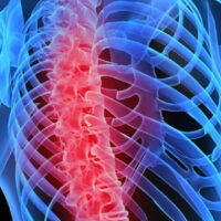 Kemik Hastalıkları