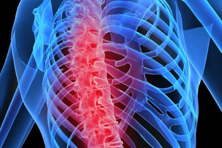 Kemik Hastalıkları Kemik Hastalıkları