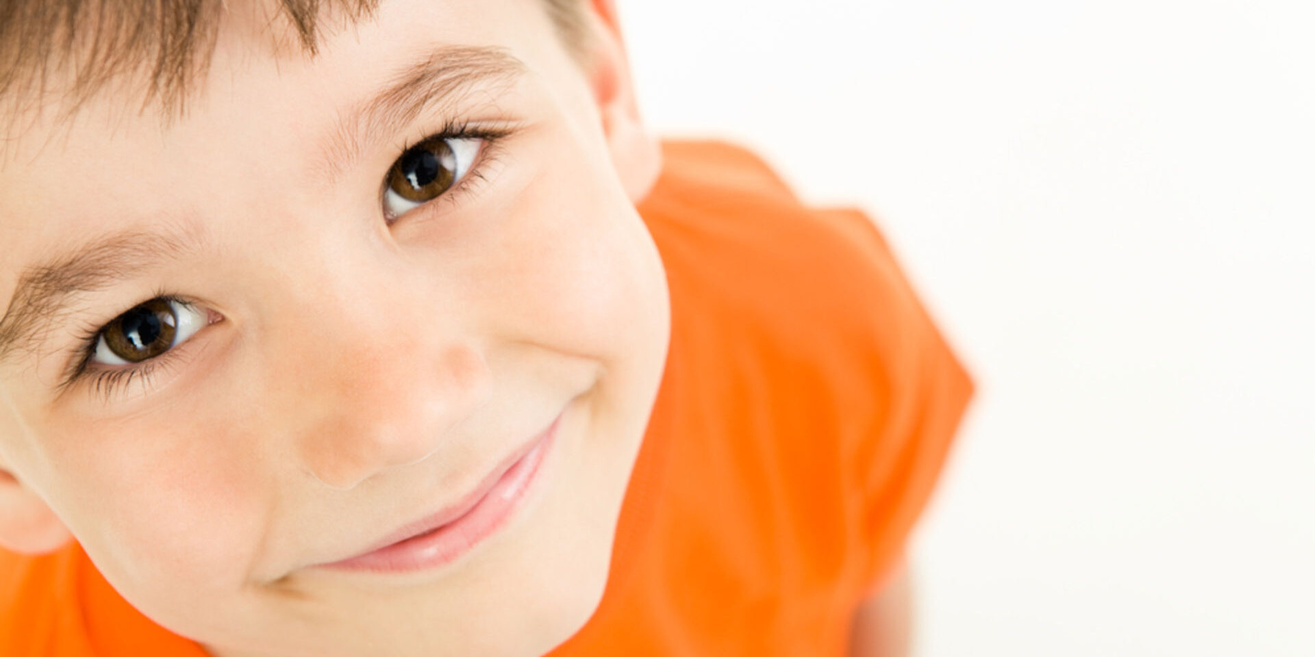 Kortizon Fazlalığı