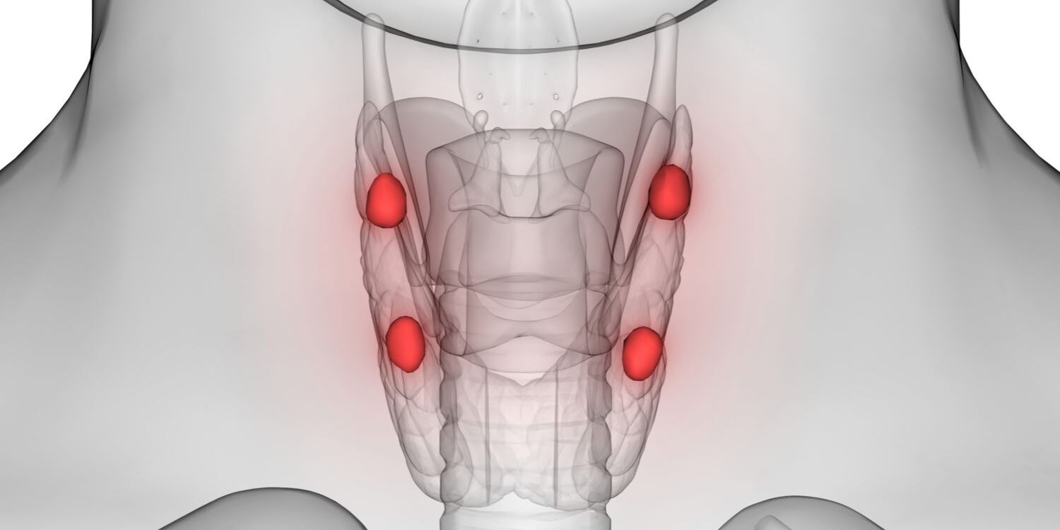 Paratiroid Bezi Hastalıkları Paratiroid Bezi Hastalıkları