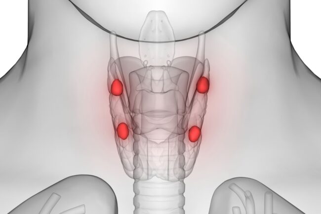 Paratiroid Bezi Hastalıkları
