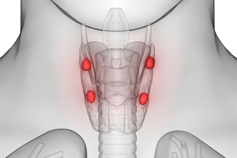 Paratiroid Bezi Hastalıkları Paratiroid Bezi Hastalıkları