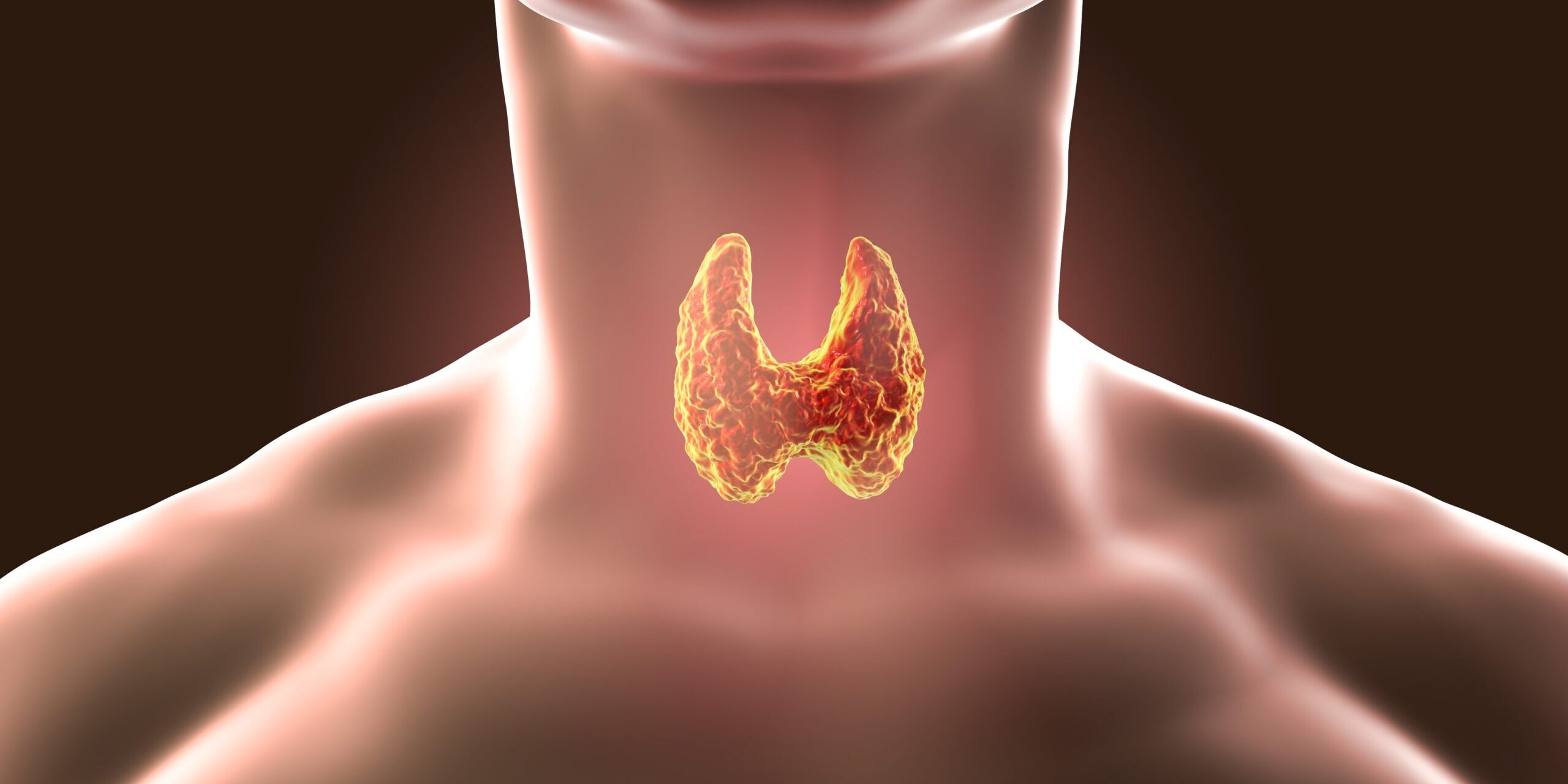 Tiroid Bezi Hastalıkları